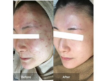 モカ 天王寺店(MOKA)