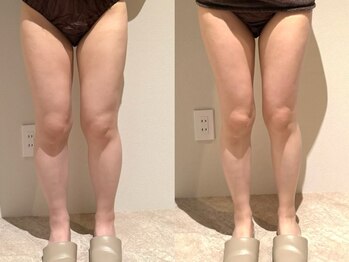 アンティアージュ 福岡本店(antiage)/下半身集中アプローチ♪