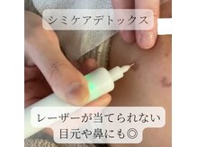 フェアリーローズ(FairyRose)の雰囲気(極上泡洗顔&シミデトックス★抗酸化美容液導入付♪)