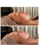 エヌア(nA)/クリスティーナ【アンストレス】