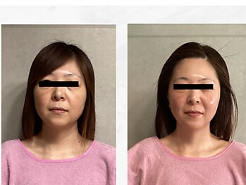 ル・ティアレ/コルギ/ Before・After