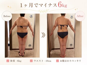 エステティック レイビス 青森店(RAYVIS)/ダイエットモニター募集中！