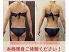 【本気痩せ!】キャビテーション+本格脂肪燃焼マッサージ¥9,900