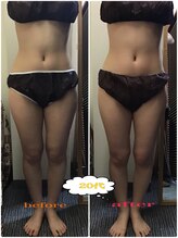 ミマインズ 倉敷本店(Me Mines)/美脚になりたい！