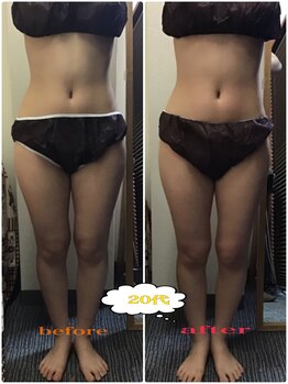 ミマインズ 倉敷本店(Me Mines)/美脚になりたい!