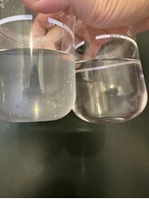 マヴィ くずは店(MavY.)/毛穴洗浄で出た見たくない汚れ