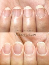マリーロール 淀屋橋本店(Marie Laure)/自爪育成/深爪矯正/ネイルケア