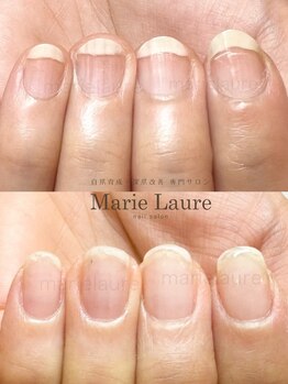 マリーロール 淀屋橋本店(Marie Laure)/自爪育成/深爪矯正/ネイルケア