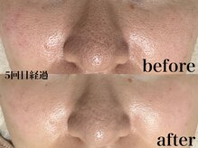 フェイシャルサロン アリイ(ALII)/