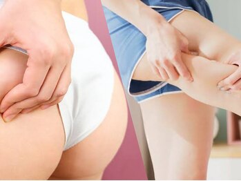 アイビー(aibe:)の写真/40代からの“下半身だけ痩せない”悩みを解消!下半身引き締めコース/初回体験¥17,500→¥6,600