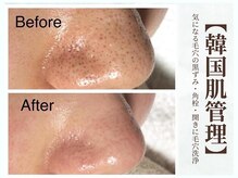 グラシーズ(Glasses)