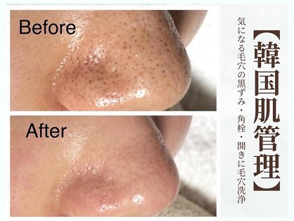 グラシーズ(Glasses)の写真