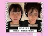 【リニューアル記念♪】小顔矯正&頚椎整体《施術時間80分》¥13,200→3,900