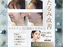 ルミライ(Lumirai)