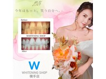 ホワイトニングショップ 秋田横手店