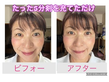 新リンパサロン 大阪の写真/頭蓋骨矯正リンパと歪み改善!新リンパの剣で最短小顔へ導きます♪