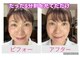 新リンパサロン 大阪の写真/頭蓋骨矯正リンパと歪み改善!新リンパの剣で最短小顔へ導きます♪
