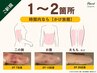 【術後ケア】インディバ70分◆腫れ/内出血/固さ DT緩和ケア ￥13000→