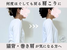 エーアール(AR)