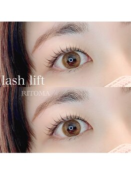 リトマ(RITOMA)/ラッシュリフト