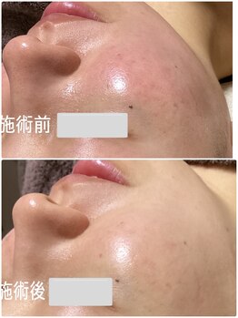 ブライトリー(Brightly)/まさにグラススキン!