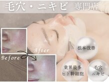 エルエルシー(L.L.C)