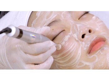 リア(lia)/生美容液導入ピーリング