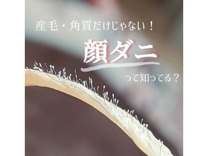 ロコワックス(Loco wax)の写真