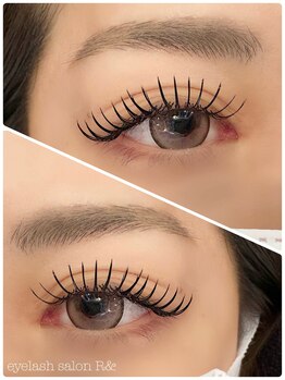 ランド(R&)/フラットラッシュ140本