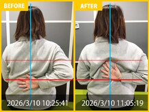 整体院 元 光の森店/頭痛と肩の痛みの悩み