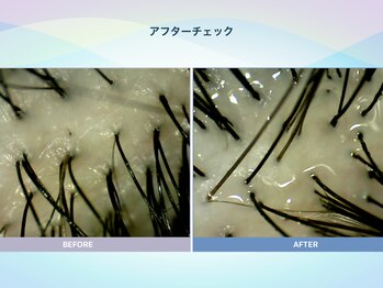 アンス(anth:)/お客様の仕上がり