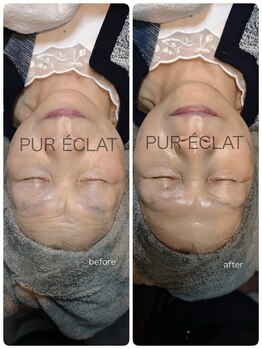 ピュールエクラ(PUR ECLAT)/シワアプローチ♪