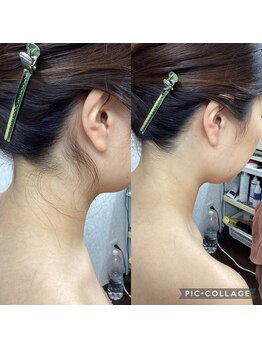 ベルビー エルエル岡崎店/襟足剃りビフォーアフター