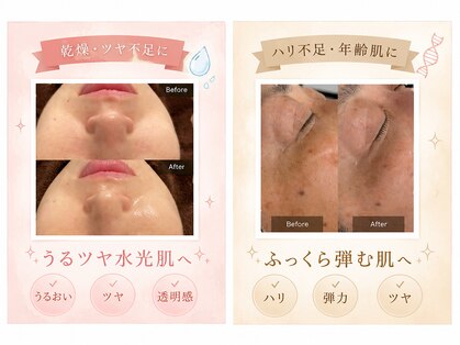 スウスウ 福岡糟屋(su:su)の写真