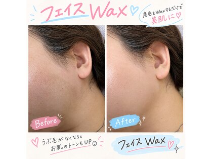 カロス(Calos)の写真