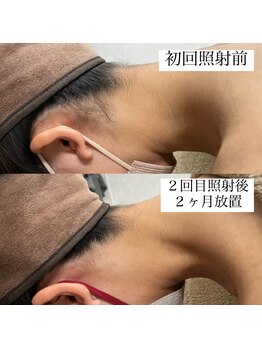 テンパ ビューティー(+10%beauty)/効果写真