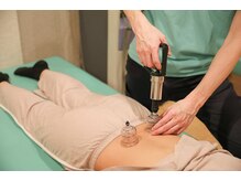 ひなはり灸整骨院/カッピング◎