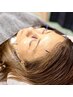 【細かい点上のしみに対応】肌環境を整える美容鍼。30代~60代におすすめ