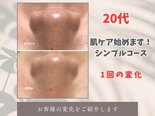 トータルビューティー雅/【お手入れ始めます！】