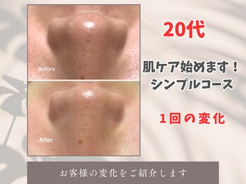 トータルビューティー雅/【お手入れ始めます!】