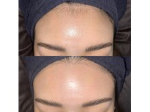 ビビ 水戸店(BiVi)/ツルツル全顔Wax