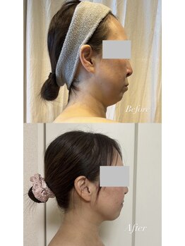 ヨサパーク レイ 等々力(YOSA PARK Ray)/座ってるだけで大量発汗