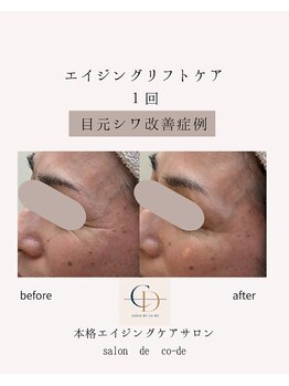 サロンドコーデ(salon de co-de)/エイジングリフトケア