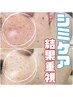 《リピーター様用》【満足な結果重視】シミケア20分し放題！