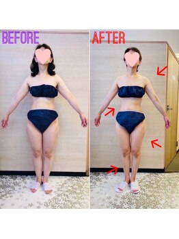 エステティックサロン アール 大阪梅田(esthetic salon R)/40代女性　前