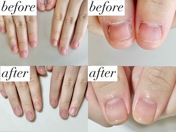 ニコワイズネイル(Nico Y's Nail)