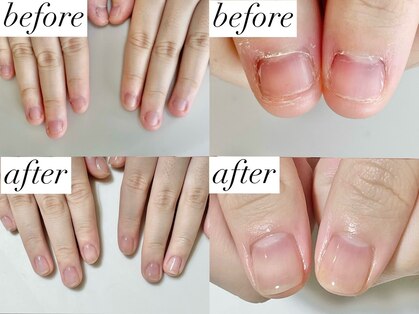 ニコワイズネイル(Nico Y's Nail)の写真