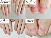ニコワイズネイル(Nico Y's Nail)