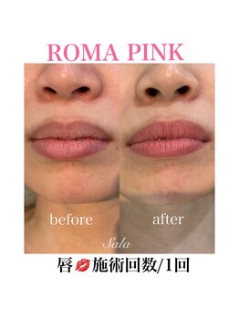 サラ/ローマピンク