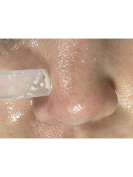 毛穴ケアをしたい